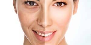 mujer sonriendo rejuvenece